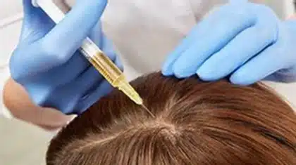 Hair Loss treatment at Dr NY Aesthetics