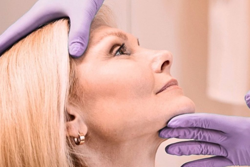 vampire facial patient